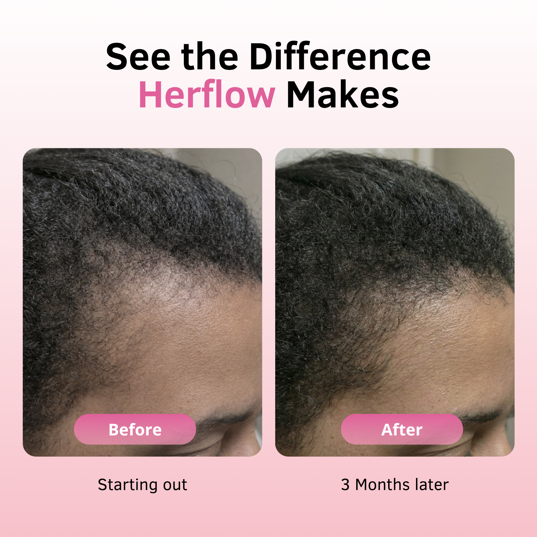 Herflow Hair Strength