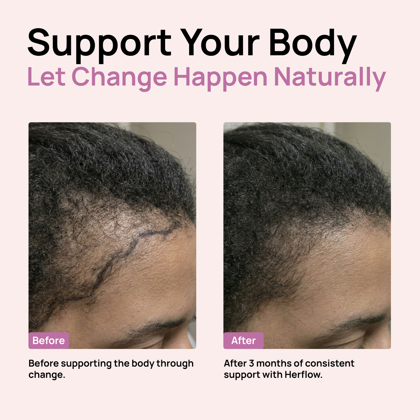 Herflow Hair Strength